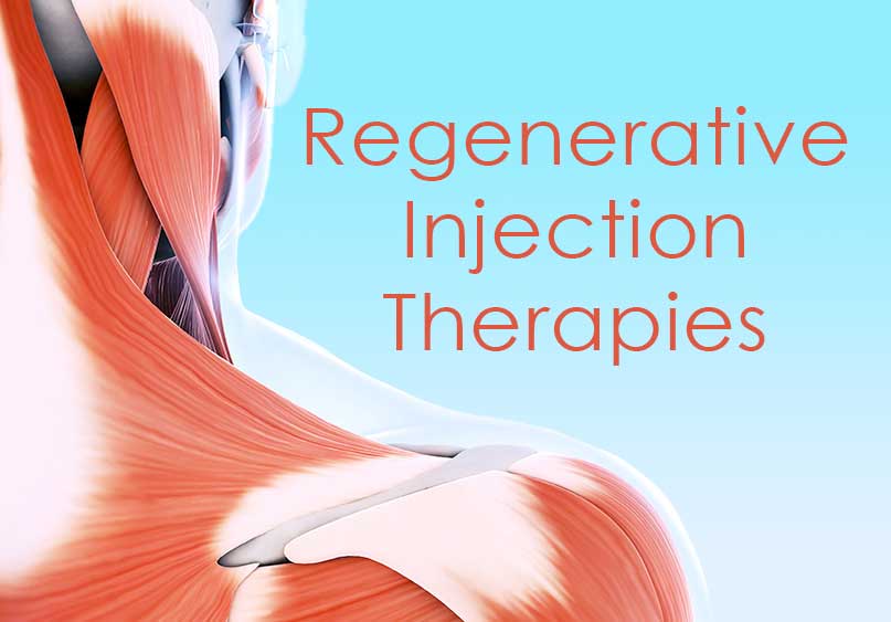 regenerative injection therapies